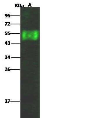 Western Blot: Influenza A H17N10 Hemagglutinin Antibody [NBP3-12749] - Influenza A H17N10 (A/little yellow-shouldered bat/Guatemala/164/2009) Hemagglutinin Recombinant ProteinLane A: 50ngSecondaryGoat Anti- Rabbit IgG H&L (Dylight 800) at 1/10000 dilution.Developed using the Odyssey technique. Performed under reducing conditions.