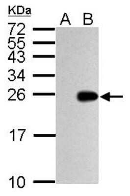 Western Blot: Influenza A H1N1 M1 Antibody - (A/Puerto Rico/8/1934) [NBP2-14995] - Sample (50 ug of whole cell lysate) A: mock DF-1 cell lysates B: WSN-infected DF-1 cell lysates 15% SDS PAGE; antibody diluted at 1:5000.