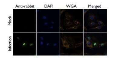 Immunocytochemistry/Immunofluorescence: Influenza A H1N1 NS1 Antibody - (A/WSN/1933) [NBP2-42871] - Analysis of A/WSN/33 infected Vero cells were fixed in 4% paraformaldehyde at RT for 20 min. Green: NS1 (H1N1) protein stained by Influenza A H1N1 NS1 antibody diluted at 1:500. Blue: DAPI staining. Yellow: WGA life stained at 37 degrees C,30 min.