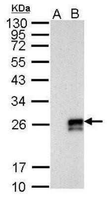 Western Blot: Influenza A H1N1 NS1 Antibody - (A/WSN/1933) [NBP2-42871] - Analysis of 10 ug whole cell lysate A: mock DF-1 cell lysates B: WSN-infected DF-1 cell lysates 12% SDS PAGE diluted at 1:1000.