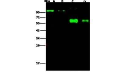Western Blot: Influenza A H1N1 Neuraminidase Antibody (2F10E12G1) - (A/California/04/2009) [NBP3-06579] - Lane A: Influenza A H1N1 (A/California/04/2009) Neuraminidase (200ng) Lane B: Influenza A H1N1 (A/California/04/2009) Neuraminidase (50ng) Lane C: Influenza A H1N1 (A/California/04/2009) Neuraminidase (Active) (200ng) Lane D: Influenza A H1N1 (A/California/04/2009) Neuraminidase (Active)(50ng) Secondary Goat Anti-Mouse IgG H&L (Dylight800) at 1/15000 dilution. Developed using the Odyssey technique. Performed under reducing conditions.