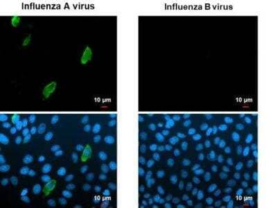 Immunocytochemistry/Immunofluorescence: Influenza A H1N1 Neuraminidase Antibody - (A/WSN/1933) [NBP2-42870] - Influenza A and B Virus infected cells slide. Green: Influenza A virus Nucleoprotein antibody diluted at 1:100.