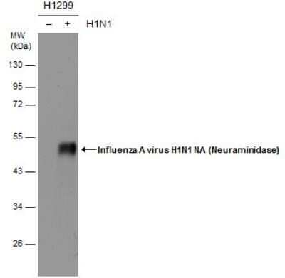 Western Blot: Influenza A H1N1 Neuraminidase Antibody - (A/WSN/1933) [NBP2-42870] - Non-infected (-) and infected (+) H1299 whole cell extracts (5 ug) were separated by 10% SDS-PAGE, and the membrane was blotted with Influenza A virus H1N1 NA (Neuraminidase) antibody diluted at 1:1000.