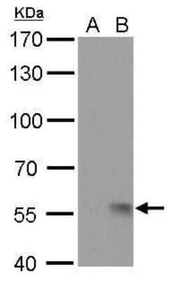 Western Blot: Influenza A H1N1 Neuraminidase Antibody (GT172) - (A/WSN/1933) [NBP3-13494] - Influenza A H1N1 Neuraminidase (NA) antibody [GT172] detects Influenza A H1N1 Neuraminidase (NA) protein by Western blot analysis. A. 30 ug DF1 whole cell lysate/extract (untreated) B. 30 ug MDA-MB-231 whole cell lysate/extract 7.5 % SDS-PAGE Influenza A H1N1 Neuraminidase (NA) antibody [GT172] (NBP3-13494) dilution: 1:5000
