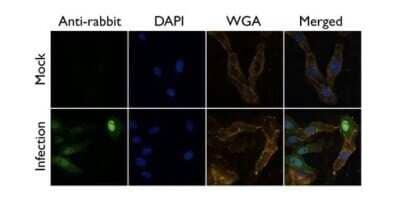 Immunocytochemistry/Immunofluorescence: Influenza A H1N1 PA Antibody - (A/Puerto Rico/8/1934) [NBP2-42875] - Analysis of A/WSN/33 infected Vero cells were fixed in 4% paraformaldehyde at RT for 20 min. Green: PA protein stained by Influenza A H1N1 PA antibody diluted at 1:500. Blue: DAPI staining. Yellow: WGA life stained at 37 degrees C 30 min.