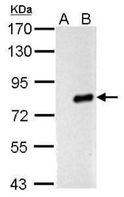 Western Blot: Influenza A H1N1 PA Antibody - (A/Puerto Rico/8/1934) [NBP2-42876] - Analysis of 30 ug whole cell lysate. A: DF1 B: WSN virus infected DF1 7.5% SDS PAGE diluted at 1:1000.