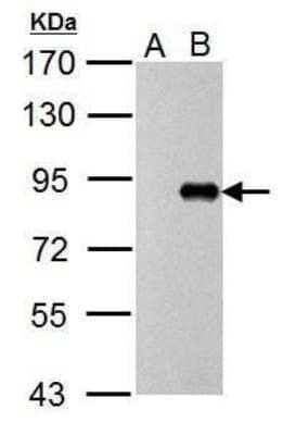 Western Blot: Influenza A H1N1 PB1 Antibody [NBP2-42877] - Analysis of : A. 5 ug DF1 whole cell lysate/extract (untreated) B. 5 ug DF1 whole cell lysate/extract (WSN virus treatment for 10hr) 7.5 % SDS-PAGE Influenza A H1N1 PB1 antibody.