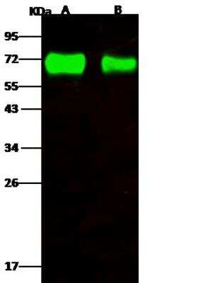 Western Blot: Influenza A H4N6 Neuraminidase Antibody [NBP3-12743] - Influenza A H4N6 (A/mallard/Ohio/657/2002) Neuraminidase / NA Recombinant ProteinLane A: 50ngLane B: 10ngSecondaryGoat Anti- Rabbit IgG H&L (Dylight 800) at 1/10000 dilution.Developed using the Odyssey technique. Performed under reducing conditions.