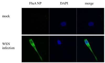 Immunocytochemistry/Immunofluorescence: Influenza A H1N1 Nucleoprotein Antibody (GT1236) [NBP3-13493] - Influenza A H1N1 Nucleoprotein antibody [GT1236] detects Influenza A H1N1 Nucleoprotein by immunofluorescent analysis. Sample: DF1 cells infected with Influenza A virus (WSN) . Green:  Influenza A H1N1 Nucleoprotein stained by Influenza A H1N1 Nucleoprotein antibody [GT1236] (NBP3-13493) diluted at 1:500. Blue: Hoechst 33342 staining.