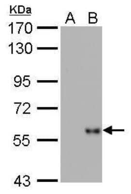 Western Blot: Influenza A H1N1 Nucleoprotein Antibody (GT1236) [NBP3-13493] - Influenza A H1N1 Nucleoprotein antibody [GT1236] detects Influenza A H1N1 Nucleoprotein by Western blot analysis. A. 5 ug DF1 whole cell lysate/extract B. 5 ug whole cell lysate/extract of WSN virus infected DF1 cells (10 hr) 7.5 % SDS-PAGE Influenza A H1N1 Nucleoprotein antibody [GT1236] (NBP3-13493) dilution: 1:5000