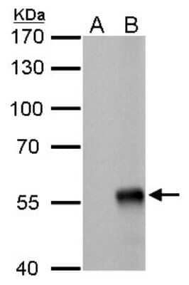 Western Blot: Influenza A H1N1 Nucleoprotein Antibody (GT778) [NBP3-13492] - Influenza A H1N1 Nucleoprotein antibody [GT778] detects Influenza A H1N1 Nucleoprotein by western blot analysis. A. 5 ug DF1 whole cell lysate/extract B. 5 ug of Influenza A H1N1 Nucleoprotein (WSN) infected DF1 cells 7.5 % SDS-PAGE Influenza A H1N1 Nucleoprotein antibody [GT778] (NBP3-13492) dilution: 1:1000