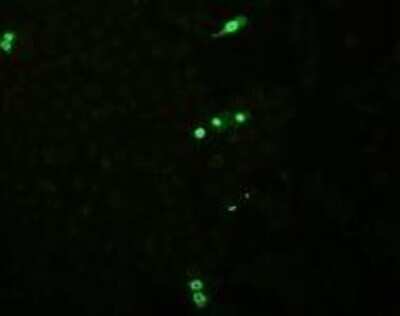 Immunocytochemistry/Immunofluorescence: Influenza B nucleoprotein Antibody (3E9/B2) [NBP2-23513] - BSA Free [NBP2-23513] - diluted 1/1000 with a secondary polyclonal rabbit anti-mouse Ig FITC conjugated antibody 1:20 + 1% Evans blue colors Influenza B nucleoprotein. Primarily the nucleus of the infected Vero cells is visible
