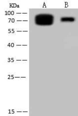 Western Blot: Influenza B nucleoprotein Antibody [NBP3-12756] - Western blot using Influenza B Nucleoprotein (B/Florida/4/2006) and Influenza B nucleoprotein antibody.Lane A: 10ngLane B: 2ngSecondary: Goat Anti-Rabbit IgG (H+L) [HRP] at 1/10000 dilutionDeveloped using the ECL technique. Performed under reducing conditions.