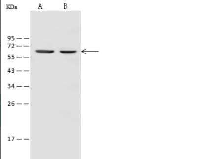 Western Blot: Influenza B Virus Nucleoprotein Antibody [NBP3-05822] - Sample Influenza B(B/Florida/4/2006) Nucleoprotein/NP ProteinLane A: 30ngLane B: 10ngSecondaryGoat Anti-Rabbit IgG (H+L)/HRP at 1/10000 dilutionPerformed under reducing conditions.