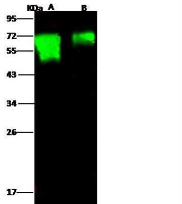 Western Blot: Influenza H18N11 Hemagglutinin Antibody [NBP3-12750] - Influenza A H18N11 (A/flat-faced bat/Peru/033/2010) Hemagglutinin / HA1 Recombinant ProteinLane A: 50ngLane B: 10ngSecondaryGoat Anti- Rabbit IgG H&L (Dylight 800) at 1/10000 dilution.Developed using the Odyssey technique. Performed under reducing conditions.