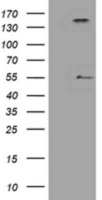 Western Blot: Inhibin alpha Antibody (12F11) [NBP2-45423] - Analysis of HEK293T cells were transfected with the pCMV6-ENTRY control (Left lane) or pCMV6-ENTRY Inhibin alpha.