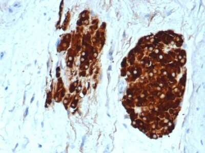 Immunohistochemistry-Paraffin: Inhibin alpha Antibody (INHA/6598R) - Azide and BSA Free [NBP3-08782] - IHC analysis of formalin-fixed, paraffin-embedded human testicular carcinoma. Staining with Inhibin alpha antibody (INHA/6598R) at 2ug/ml in PBS for 30min RT. HIER: Tris/EDTA, pH9.0, 45min. 2 : HRP-polymer, 30min. DAB, 5min.
