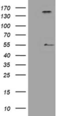 Western Blot: Inhibin alpha Antibody (OTI12F11) - Azide and BSA Free [NBP2-71039] - Analysis of HEK293T cells were transfected with the pCMV6-ENTRY control (Left lane) or pCMV6-ENTRY Inhibin alpha.