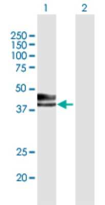 Western Blot: Inhibin alpha Antibody [H00003623-B01P] - Analysis of INHA expression in transfected 293T cell line by INHA polyclonal antibody.  Lane 1: INHA transfected lysate(40.26 KDa). Lane 2: Non-transfected lysate.