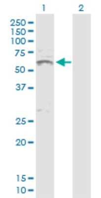 Western Blot: Activin A Antibody [H00003624-D01P] - Analysis of Activin A expression in transfected 293T cell line by Activin A polyclonal antibody.Lane 1: Activin A transfected lysate(47.40 KDa).Lane 2: Non-transfected lysate.