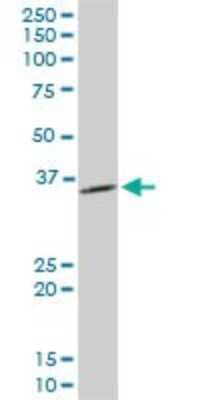 Western Blot: Inorganic Pyrophosphatase/PPA1 Antibody (3B2) [H00005464-M01] - PPA1 monoclonal antibody (M01), clone 3B2. Analysis of PPA1 expression in PC-12.