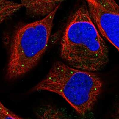 <b>Independent Antibodies Validation. </b>Immunocytochemistry/Immunofluorescence: Inorganic Pyrophosphatase/PPA1 Antibody [NBP1-87787] - Immunofluorescent staining of human cell line U-2 OS shows localization to vesicles.