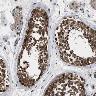 Immunohistochemistry-Paraffin: Inorganic Pyrophosphatase/PPA1 Antibody [NBP1-87787] - Staining of human testis shows cytoplasmic and nuclear positivity in cells in seminiferous ducts and Leydig cells.