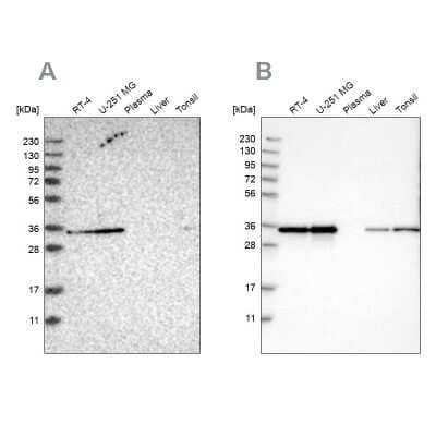 Western Blot: Inorganic Pyrophosphatase/PPA1 Antibody [NBP1-87787] - Analysis using Anti-PPA1 antibody NBP1-87787 (A) shows similar pattern to independent antibody NBP1-87788 (B).