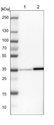 Western Blot: Inorganic Pyrophosphatase/PPA1 Antibody [NBP1-87788] - Lane 1: NIH-3T3 cell lysate (Mouse embryonic fibroblast cells). Lane 2: NBT-II cell lysate (Rat Wistar bladder tumor cells).