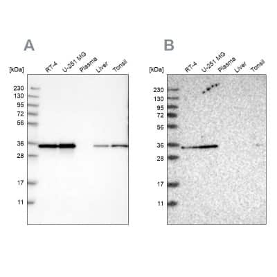 Western Blot: Inorganic Pyrophosphatase/PPA1 Antibody [NBP1-87788] - Analysis using Anti-PPA1 antibody NBP1-87788 (A) shows similar pattern to independent antibody NBP1-87787 (B).