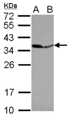 Western Blot: Inorganic Pyrophosphatase/PPA1 Antibody [NBP2-20021] - Sample (30 ug of whole cell lysate) A: IMR32 B: U87-MG 12% SDS PAGE gel, diluted at 1:10000.