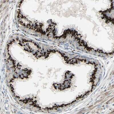 Immunohistochemistry-Paraffin: Inositol Monophosphatase 3/IMPAD1 Antibody [NBP1-83655] - Staining of human prostate shows strong cytoplasmic positivity with granular pattern in glandular cells.