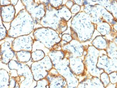 Immunohistochemistry-Paraffin: Insulin R/CD220 Antibody (INSR/2277R) - Azide and BSA Free [NBP3-08838] - Formalin-fixed, paraffin-embedded human Placenta stained with Insulin R/CD220 Rabbit Recombinant Monoclonal Antibody (INSR/2277R).