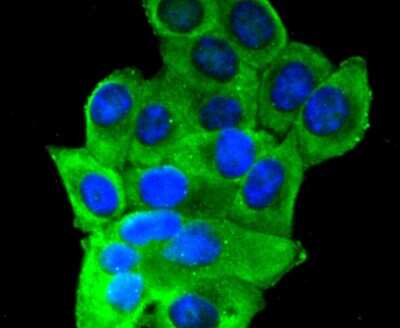 Immunocytochemistry/Immunofluorescence: Insulin R/CD220 Antibody (SN20-13) - alpha-subunit [NBP2-67726] - Insulin Receptor Antibody (SN20-13) [NBP2-67726] - Staining Insulin Receptor in HepG2 cells (green). The nuclear counter stain is DAPI (blue). Cells were fixed in paraformaldehyde, permeabilised with 0.25% Triton X100/PBS.