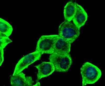 Immunocytochemistry/Immunofluorescence: Insulin R/CD220 Antibody (SN20-13) - alpha-subunit [NBP2-67726] - Insulin Receptor Antibody (SN20-13) [NBP2-67726] - Staining Insulin Receptor in LO2 cells (green). The nuclear counter stain is DAPI (blue). Cells were fixed in paraformaldehyde, permeabilised with 0.25% Triton X100/PBS.