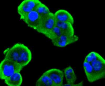 Immunocytochemistry/Immunofluorescence: Insulin R/CD220 Antibody (SN20-13) - alpha-subunit [NBP2-67726] - Insulin Receptor Antibody (SN20-13) [NBP2-67726] - Staining Insulin Receptor in PANC-1 cells (green). The nuclear counter stain is DAPI (blue). Cells were fixed in paraformaldehyde, permeabilised with 0.25% Triton X100/PBS.