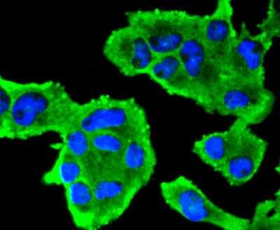 Immunocytochemistry/Immunofluorescence: Insulin R/CD220 Antibody (SN20-13) - alpha-subunit [NBP2-67726] - Insulin Receptor Antibody (SN20-13) [NBP2-67726] - Staining Insulin Receptor in RH-35 cells (green). The nuclear counter stain is DAPI (blue). Cells were fixed in paraformaldehyde, permeabilised with 0.25% Triton X100/PBS.