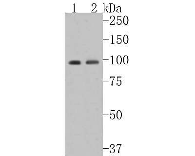 Western Blot: Insulin R/CD220 Antibody (SN20-13) - alpha-subunit [NBP2-67726] - Western blot analysis of Insulin R/CD220 on different lysates. Proteins were transferred to a PVDF membrane and blocked with 5% BSA in PBS for 1 hour at room temperature. The primary antibody (1/500) was used in 5% BSA at room temperature for 2 hours. Goa