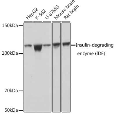 Western Blot: Insulysin/IDE Antibody (8O8F3) [NBP3-15352] - Western blot analysis of extracts of various cell lines, using Insulin-degrading enzyme (Insulysin/IDE) Rabbit mAb (NBP3-15352) at 1:1000 dilution. Secondary antibody: HRP Goat Anti-Rabbit IgG (H+L) at 1:10000 dilution. Lysates/proteins: 25ug per lane. Blocking buffer: 3% nonfat dry milk in TBST. Detection: ECL Basic Kit. Exposure time: 1s.