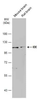 Western Blot: Insulysin/IDE Antibody (GT143) [NBP3-13560] - Various tissue extracts (50 ug) were separated by 7.5% SDS-PAGE, and the membrane was blotted with Insulysin/IDE antibody [GT143] (NBP3-13560) diluted at 1:1000. The HRP-conjugated anti-mouse IgG antibody (NBP2-19382) was used to detect the primary antibody.