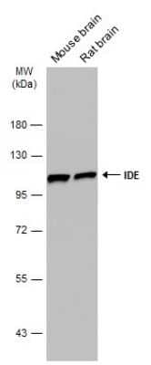 Western Blot: Insulysin/IDE Antibody (GT286) [NBP3-13547] - Various tissue extracts (50 ug) were separated by 7.5% SDS-PAGE, and the membrane was blotted with Insulysin/IDE antibody [GT286] (NBP3-13547) diluted at 1:1000. The HRP-conjugated anti-mouse IgG antibody (NBP2-19382) was used to detect the primary antibody.