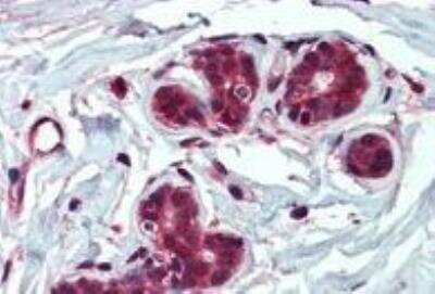 Immunohistochemistry-Paraffin: Insulysin/IDE Antibody [NB100-68148] - Human Breast tissue. Antibody at 2.5 ug/mL. Steamed antigen retrieval with citrate buffer (pH 6), AP-staining.