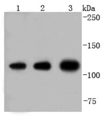 Western Blot: Insulysin/IDE Antibody (JJ0949) [NBP2-66907] - Analysis of Insulin degrading enzyme on different lysates using anti-Insulin degrading enzyme antibody at 1/1,000 dilution. Positive control:  Lane 1: zebrafish  Lane 2: Hela  Lane 3: K562