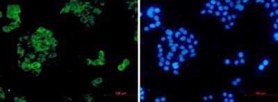 Immunocytochemistry/Immunofluorescence: Insulysin/IDE Antibody (S04-4E8) [NBP3-19987] - Immunocytochemistry of Insulysin/IDE (green) in hela using NBP3-19987 at dilution 1/50, and DAPI (blue)