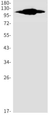 Western Blot: Insulysin/IDE Antibody (S04-4E8) [NBP3-19987] - Western blot detection of Insulysin/IDE in A549 (Lane 1), HL-60 (Lane 2), U2OS (Lane 3) cell lysates using NBP3-19987 (1:1000 diluted). Predicted band size: 118kDa. Observed band size: 118kDa.