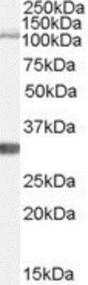 Western Blot: Insulysin/IDE Antibody [NB100-61667] -  (1ug/ml) staining of Mouse Brain lysate (35ug protein in RIPA buffer). Primary incubation was 1 hour. Detected by chemiluminescence.