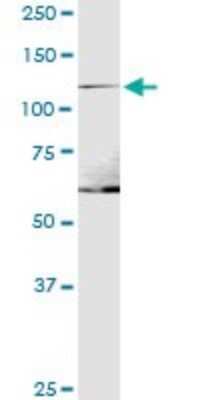 Western Blot: Integrin alpha 1/CD49a Antibody [H00003672-B01P] - Analysis of ITGA1 expression in K-562.