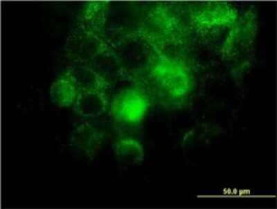 Immunocytochemistry/Immunofluorescence: Integrin alpha 2/CD49b Antibody (2B6) [H00003673-M01] - Analysis of monoclonal antibody to ITGA2 on A-431 cell. Antibody concentration 10 ug/ml.