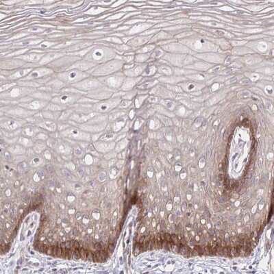 Immunohistochemistry-Paraffin: Integrin alpha 2/CD49b Antibody [NBP2-38902] - Staining of human cervix, uterine shows moderate cytoplasmic positivity in basal squamous epithelial cells.