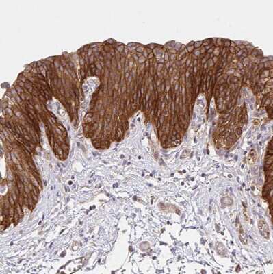 Immunohistochemistry-Paraffin: Integrin alpha 2/CD49b Antibody [NBP2-38902] - Staining of human urinary bladder shows moderate to strong membranous positivity in urothelial cells.